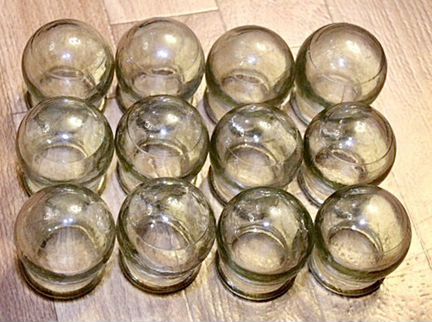 Банки стеклянные лечебные СССР 10 штук