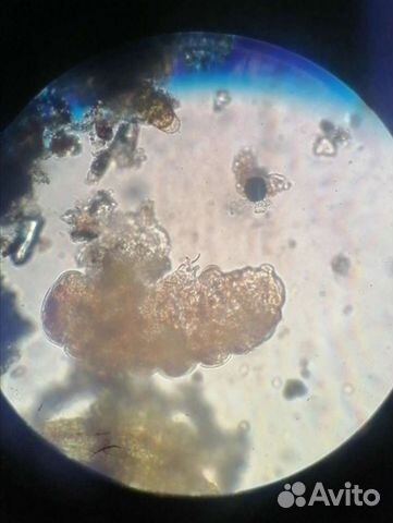 Водяной медведь (тихоходка)