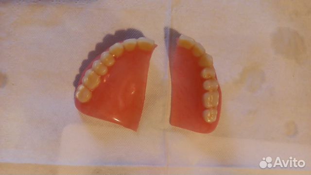 Срочный ремонт зубных протезов В Москве