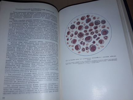 Кассирский И. Клиническая гематология. 1955 г